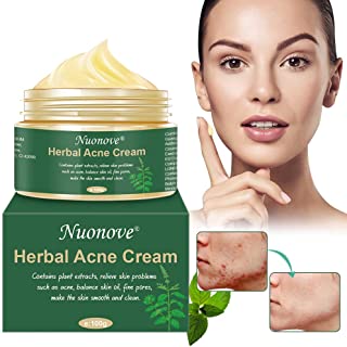 Acne Crema, Crema Anti Acne, Crema Acne, Crema Cicatrici Acne, Crema Viso Acne, Gel anti acne per il viso, il collo, petto e sch